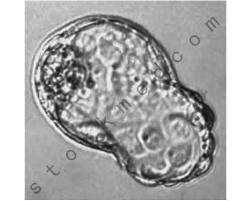 国内的私立供卵医院,三胎做三代试管婴儿选男孩价格多少,费用10万够吗? 国内的私立供卵医院,三胎做三代试管婴儿选男孩价格多少,费用10万够吗?