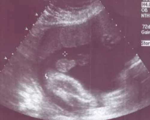 国内试管别人代生,卵泡闭锁有怀孕可能吗？3招让备孕成功率翻倍！