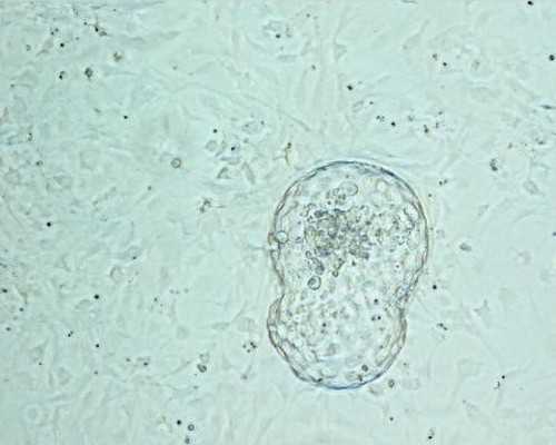 国内供卵一般要等好久,曲靖市妇幼保健院做第二代试管婴儿开始 促排过程分享