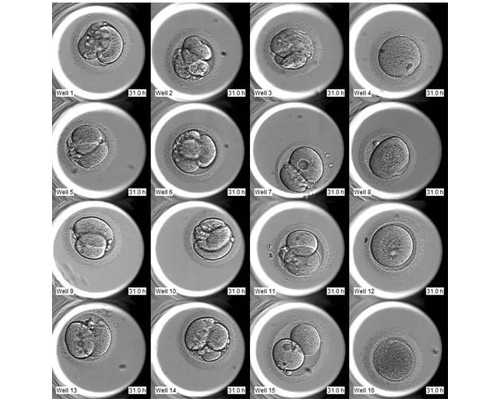 国内做供卵试管婴儿的医院,试管前什么时候开始检查？做试管婴儿前的检查需要多长时间 ...