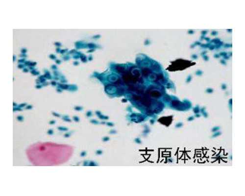 国内供卵试管不用排队,试管自然周期促排卵*率 自然周期促排卵泡容不容易取