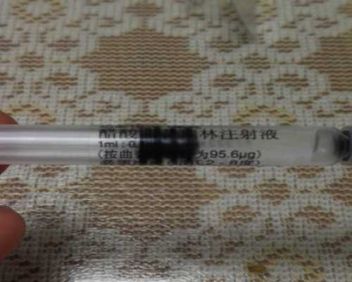 国内试管供卵医院哪家好,涤纶短纤和长纤的区别（涤纶短纤与涤纶长丝有什么区别）