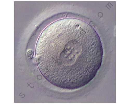 国内供卵的详细流程,解析试管婴儿移植着床率，年龄是影响因素之一