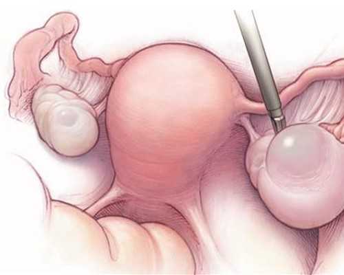 国内供卵中心排名,惹是*非的意思（惹是*非）