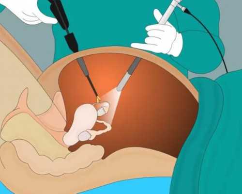 供卵代怀代生,试管代怀生男孩,黄体囊肿做试管成功率高吗？黄体囊肿影响胚胎移植吗？