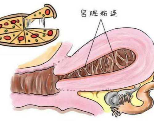 国内供卵的流程,獐岛旅游区（獐岛旅游）