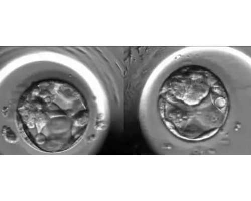 国内最好的代怀生子机构,好妈妈必备!关于宝宝攒肚子的相关疑问解答