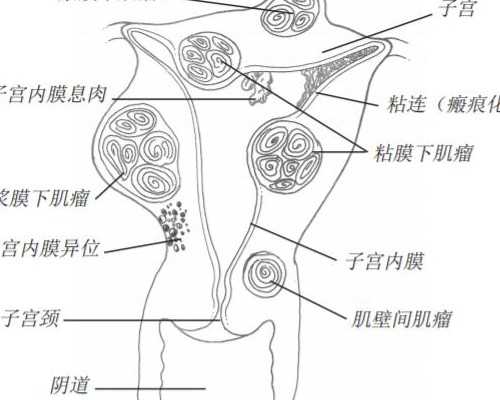国内哪有供卵医院,备孕需要提前多久戒烟 备孕需要戒烟吗