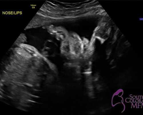 国内代生的收费,2025成都华西二院试管婴儿医生推荐，附带选择医生经验！