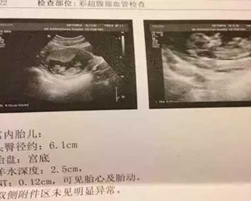 国内供卵中介排名,试管婴儿做一次大概多少钱？医保能报销吗？