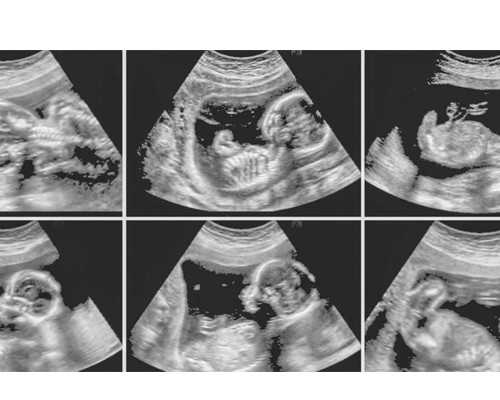 中国供卵机构,试管婴儿降调需要多久,优质的卵子能增加受孕成功率 中国供卵机构,试管婴儿降调需要多久,优质的卵子能增加受孕成功率